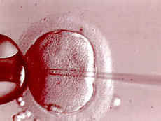 Injecting one sperm directly into the egg (ICSI)